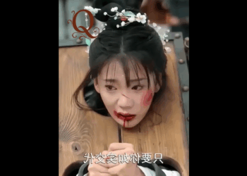 N2110014 เด กหน มช วยช ตนกว เศษท บาดเจ บ, โชคชะตาก พล กผ นท นท part2